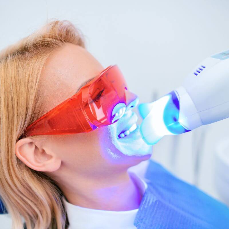 800x800 Servicio de Blanqueamiento Dental Armonika Odontología